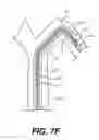 Fig. 15 - Dilator systems and methods