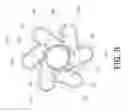Fig. 09 - BALLOON CATHETER