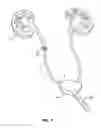 Fig. 06 - URETERAL STENT AND METHOD AND SYSTEM FOR ITS DEPLOYMENT