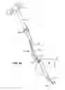 Fig. 07 - URETERAL STENT AND METHOD AND SYSTEM FOR ITS DEPLOYMENT
