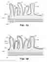 Fig. 05 - Medical device with a structured coating