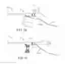 Fig. 04 - Delivery catheter apparatus and methods