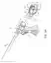 Fig. 05 - Delivery catheter apparatus and methods