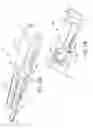 Fig. 15 - Delivery catheter apparatus and methods