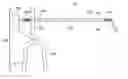 Fig. 01 - ENDOCARDIAL LEAD CUTTING APPARATUS