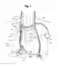 Fig. 02 - System and method to modulate phrenic nerve to prevent sleep apnea