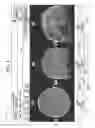 Fig. 03 - SYSTEM AND METHOD FOR DETERMINING TARGET STIMULATION VOLUMES