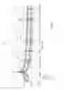 Fig. 10 - Electrical contacts on a medical device patch