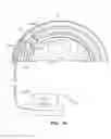 Fig. 24 - Systems, methods and devices for a skull/brain interface