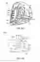 Fig. 45 - Golf club head