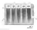 Fig. 02 - High speed granule delivery system and method