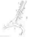 Fig. 08 - Pick up device with telescoping tube