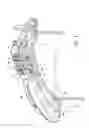 Fig. 06 - Manway cover with seal
