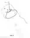 Fig. 08 - WOOD CHIPPER HOOK