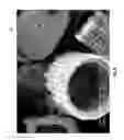 Fig. 04 - Diatomaceous energy storage devices