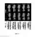 Fig. 10 - Methods and compositions for radiohalogen protein labeling