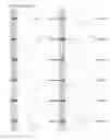 Fig. 17 - Kappa opioid receptor selective compounds, compositions, and uses thereof