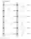 Fig. 18 - Kappa opioid receptor selective compounds, compositions, and uses thereof