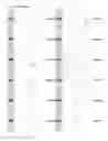 Fig. 32 - Kappa opioid receptor selective compounds, compositions, and uses thereof