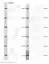 Fig. 34 - Kappa opioid receptor selective compounds, compositions, and uses thereof
