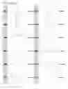 Fig. 35 - Kappa opioid receptor selective compounds, compositions, and uses thereof