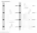 Fig. 46 - Kappa opioid receptor selective compounds, compositions, and uses thereof