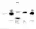 Fig. 02 - Methods for the treatment of mitochondrial diseases associated with a mutation in or gene resulting in a disruption of mitochondrial oxidative phosphorylation