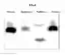 Fig. 19 - Methods for the treatment of mitochondrial diseases associated with a mutation in or gene resulting in a disruption of mitochondrial oxidative phosphorylation