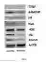 Fig. 07 - Treating human immunodeficiency virus infections
