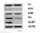 Fig. 14 - Treating human immunodeficiency virus infections