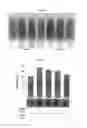 Fig. 04 - Microphthalmia-associated transcription factor-derived peptide and composition containing same
