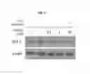 Fig. 06 - Microphthalmia-associated transcription factor-derived peptide and composition containing same