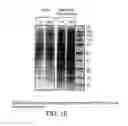 Fig. 24 - SERPINS: METHODS OF THERAPEUTIC BETA-CELL REGENERATION AND FUNCTION
