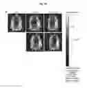 Fig. 17 - Antibodies against TM4SF5 and methods of use thereof