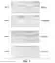 Fig. 06 - HER1 antigen binding proteins binding to the beta-hairpin of HER1