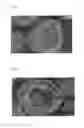 Fig. 04 - Method for preparing polymer microparticles by spray process