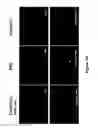 Fig. 06 - Selective cell therapy for the treatment of renal failure