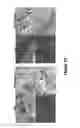 Fig. 12 - Selective cell therapy for the treatment of renal failure