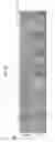 Fig. 04 - Method for suppressing teratoma formation via selective cell death induction in undifferentiated human-induced pluripotent stem cells