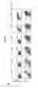 Fig. 05 - Method for suppressing teratoma formation via selective cell death induction in undifferentiated human-induced pluripotent stem cells