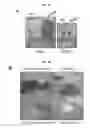 Fig. 17 - Method for suppressing teratoma formation via selective cell death induction in undifferentiated human-induced pluripotent stem cells