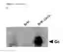 Fig. 06 - Methods to produce bunyavirus replicon particles