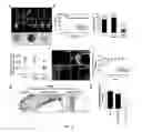 Fig. 12 - METHODS AND COMPOSITIONS FOR MANAGING VASCULAR CONDITIONS