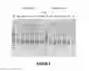 Fig. 06 - Antisense oligonucleotides for inducing exon skipping and methods of use thereof