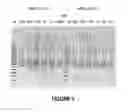 Fig. 06 - Antisense oligonucleotides for inducing exon skipping and methods of use thereof