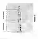 Fig. 18 - Antisense oligonucleotides for inducing exon skipping and methods of use thereof