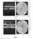 Fig. 04 - Methods and compositions for treating genetically linked diseases of the eye