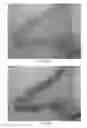 Fig. 09 - Proximity assay for in situ detection of targets