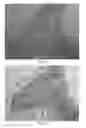 Fig. 10 - Proximity assay for in situ detection of targets