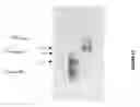 Fig. 16 - Methods of multiplexing DNA sensors and localizing DNA sensor